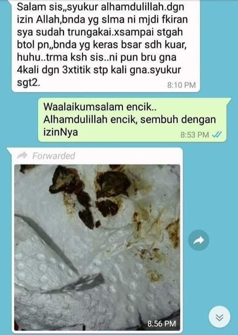 Masalah Tahi Telinga Keras & Tersumbat