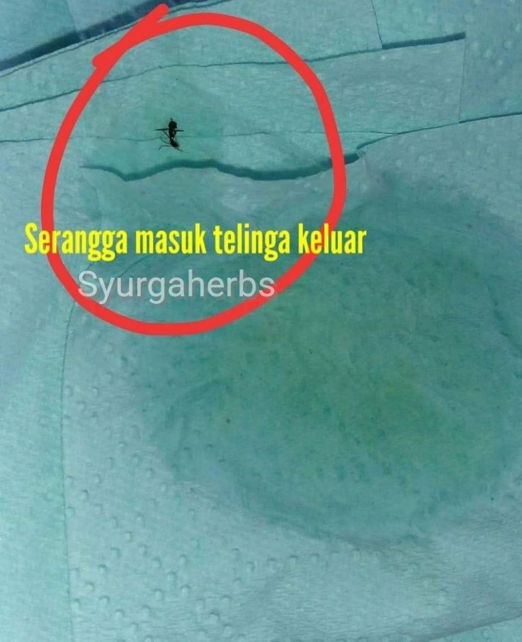 Telinga Dimasuki Serangga