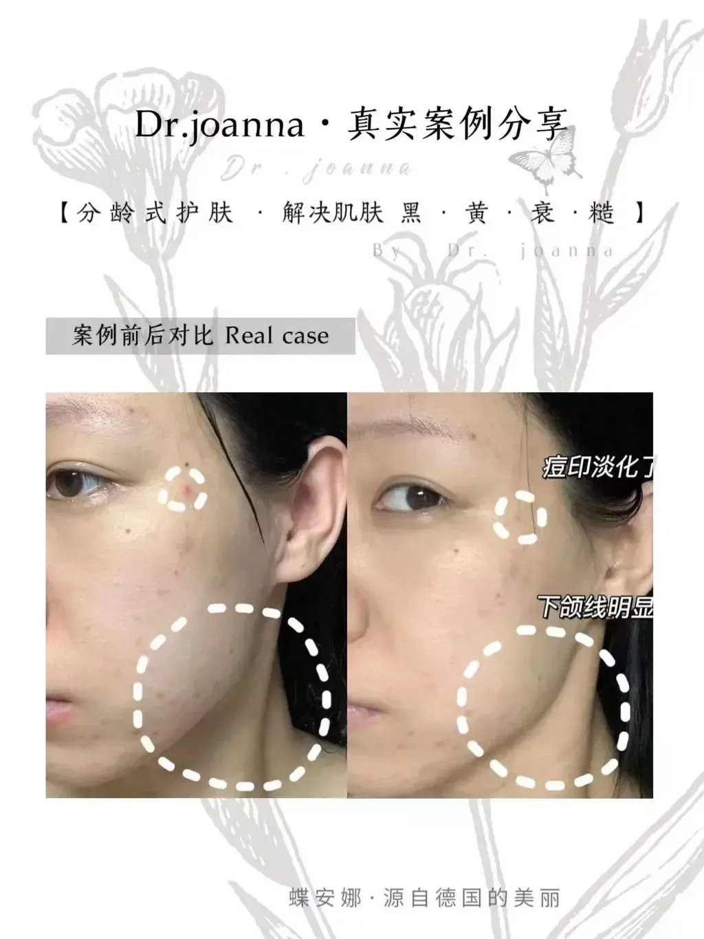 0640AC3B-7659-4668-8C47-50C0DB50181F