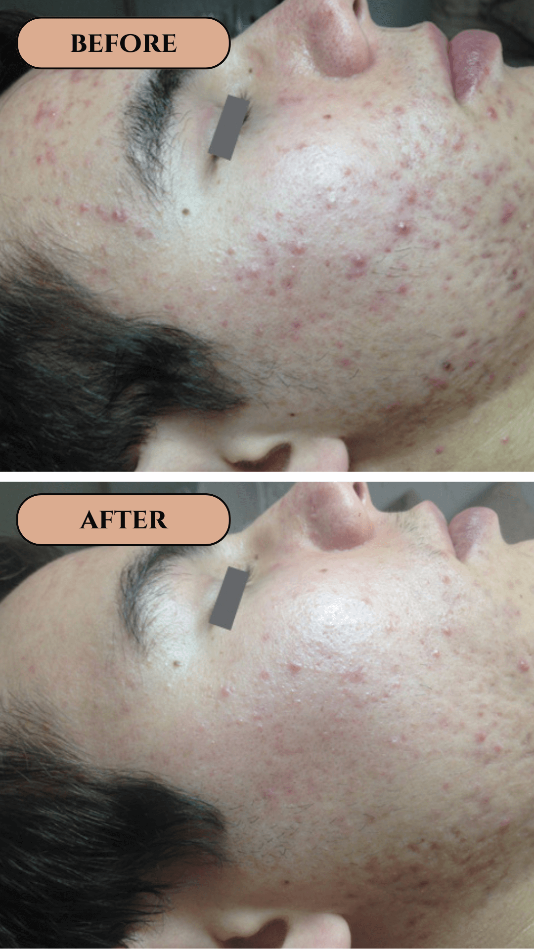 product result