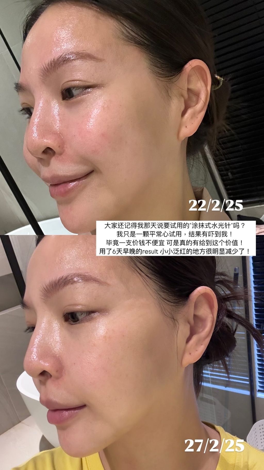 3033e318e2a79bfc0835f87ef6f80b9d