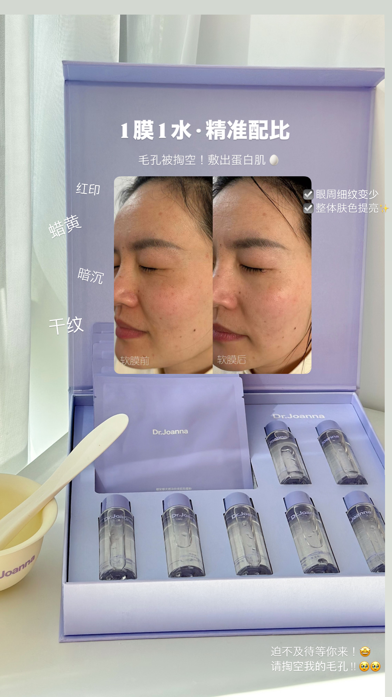 CD80BD56-82E2-45C3-8210-D81E674327E2