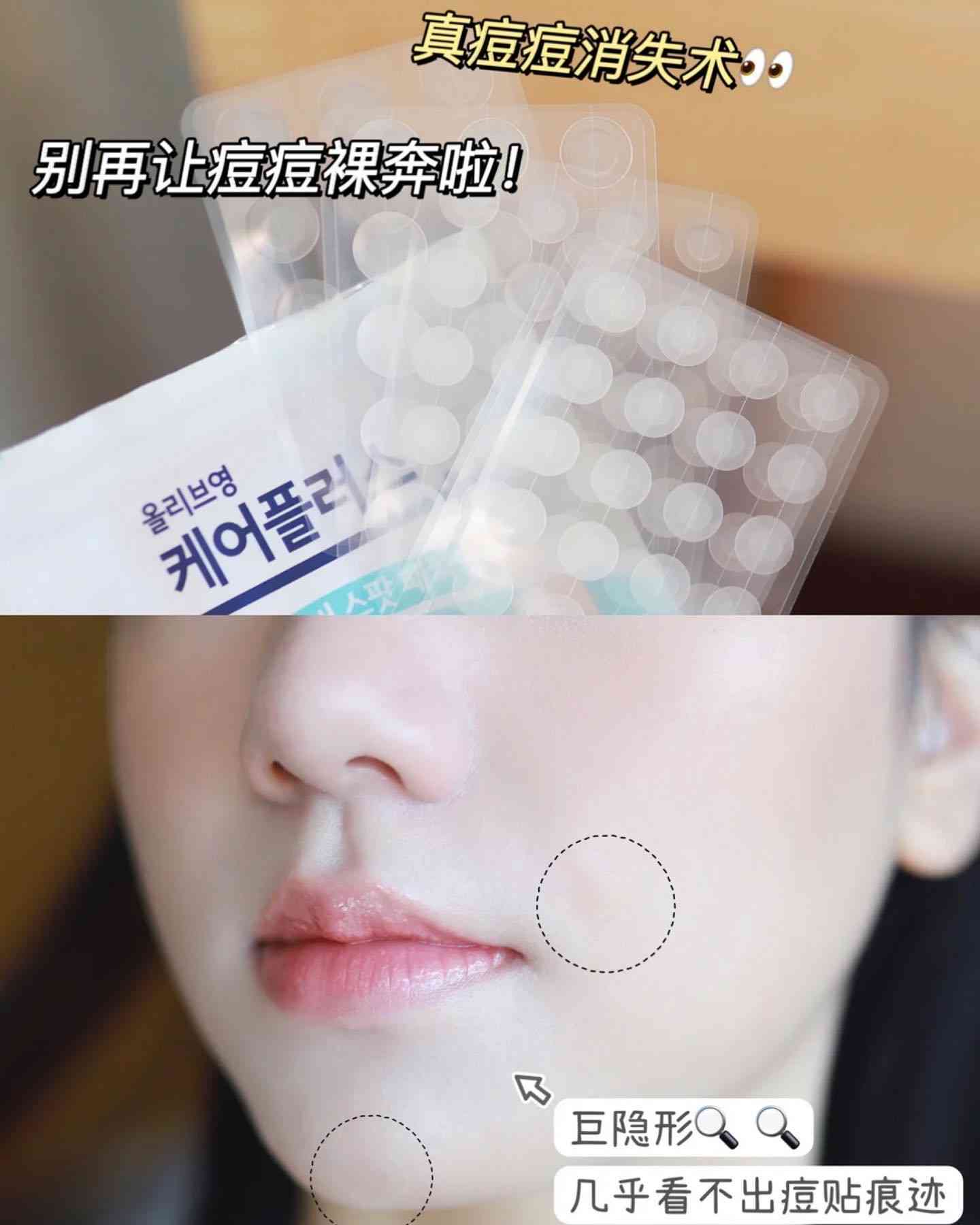 Olive Young 隐形痘痘贴