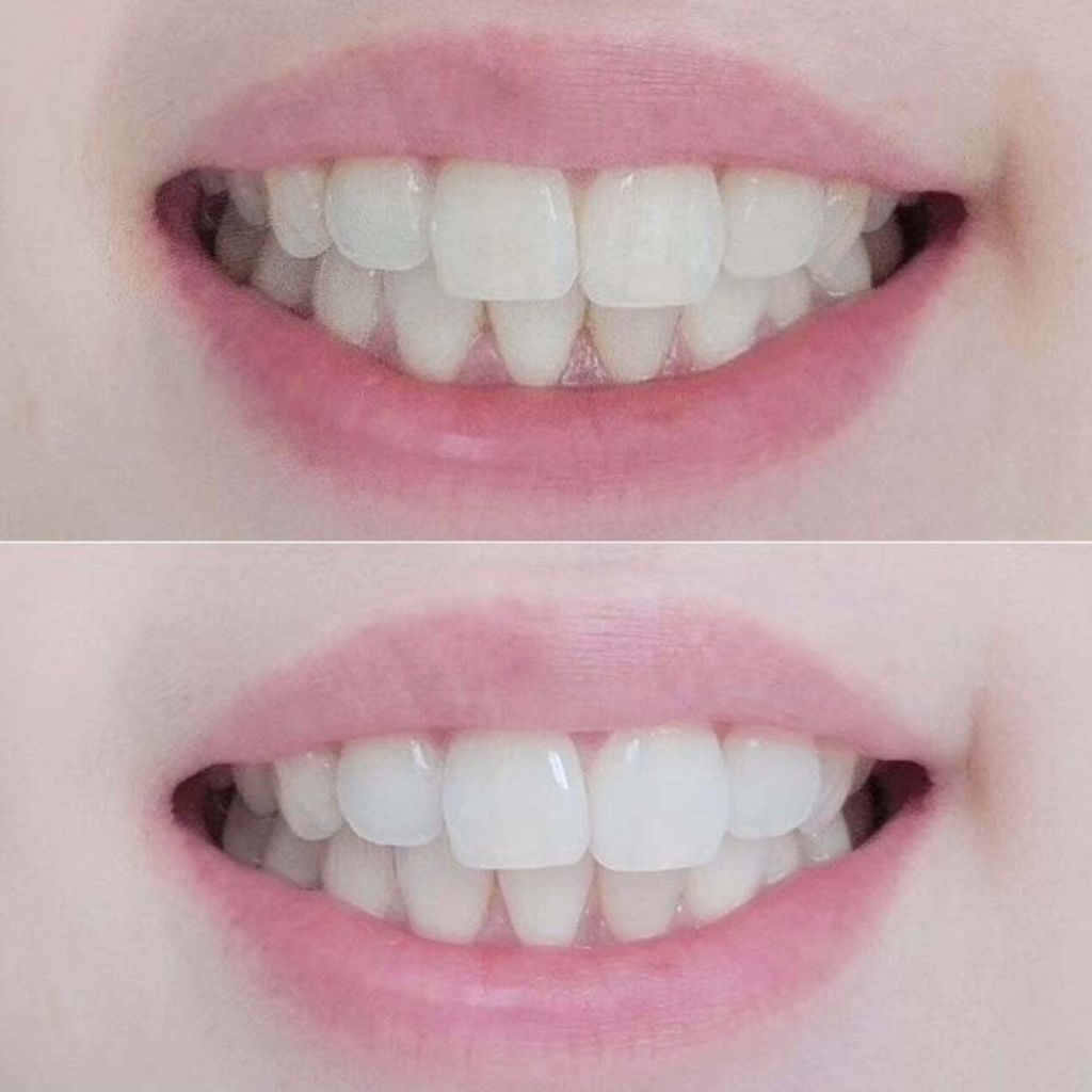 ABC06131-0829-428A-A780-B5E9C180749A