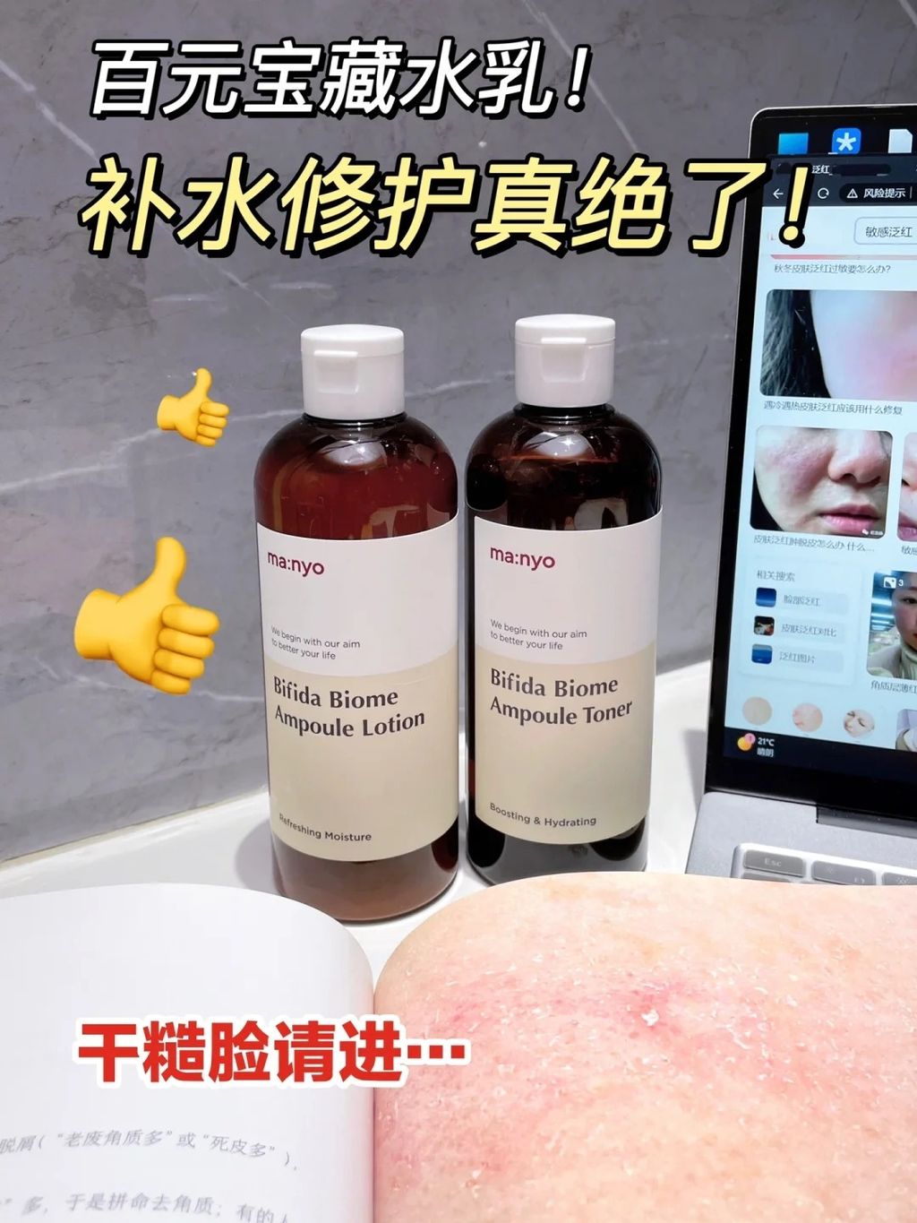 [韩国] Manyo 益生菌爽肤水套组 1+1