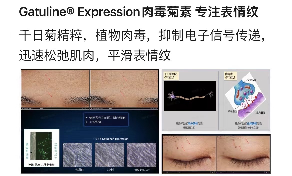 bdea1c54b530aa4bcaa5b283c64a9851-1715750697865