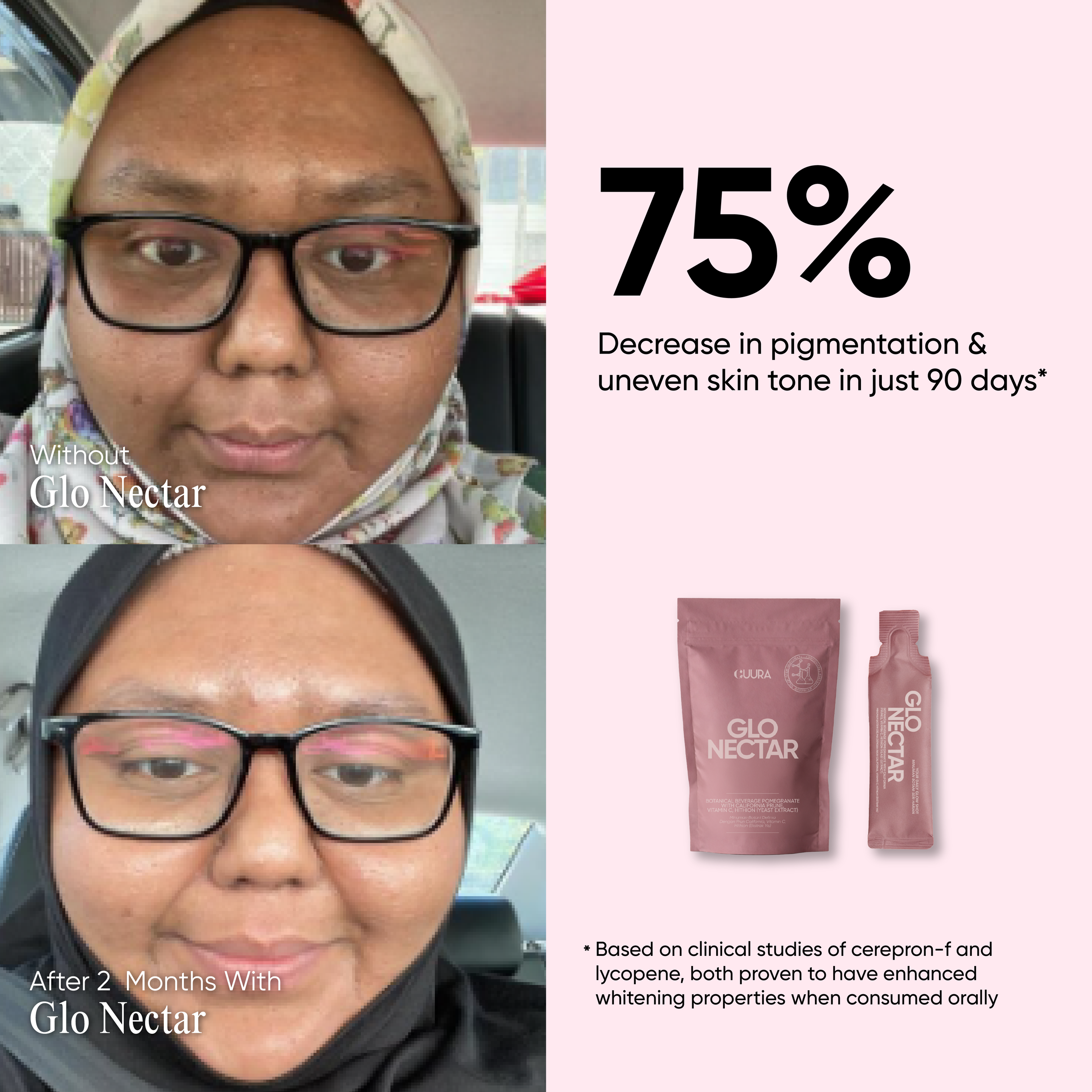 GLONECTAR POSTING-02