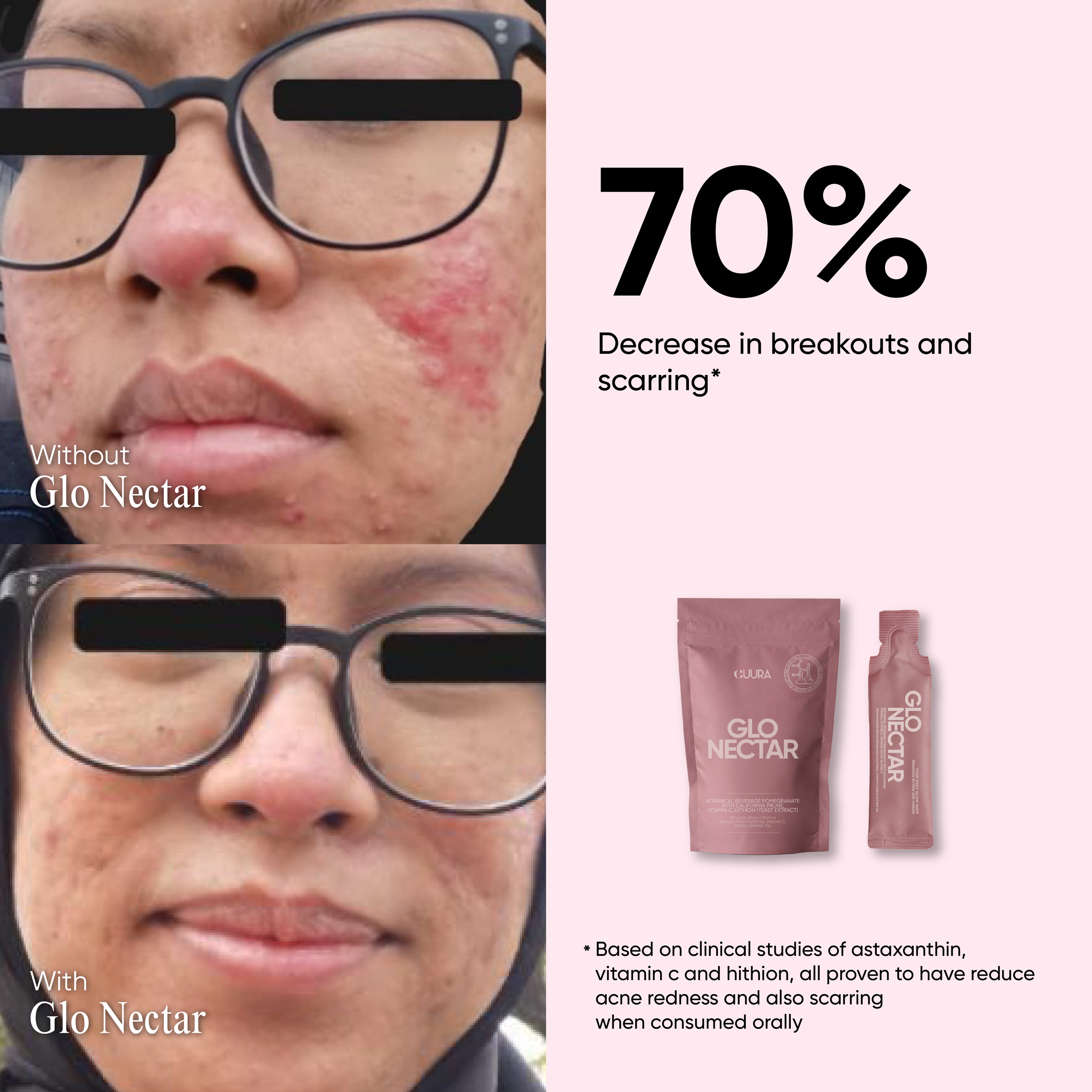 GLONECTAR POSTING-04