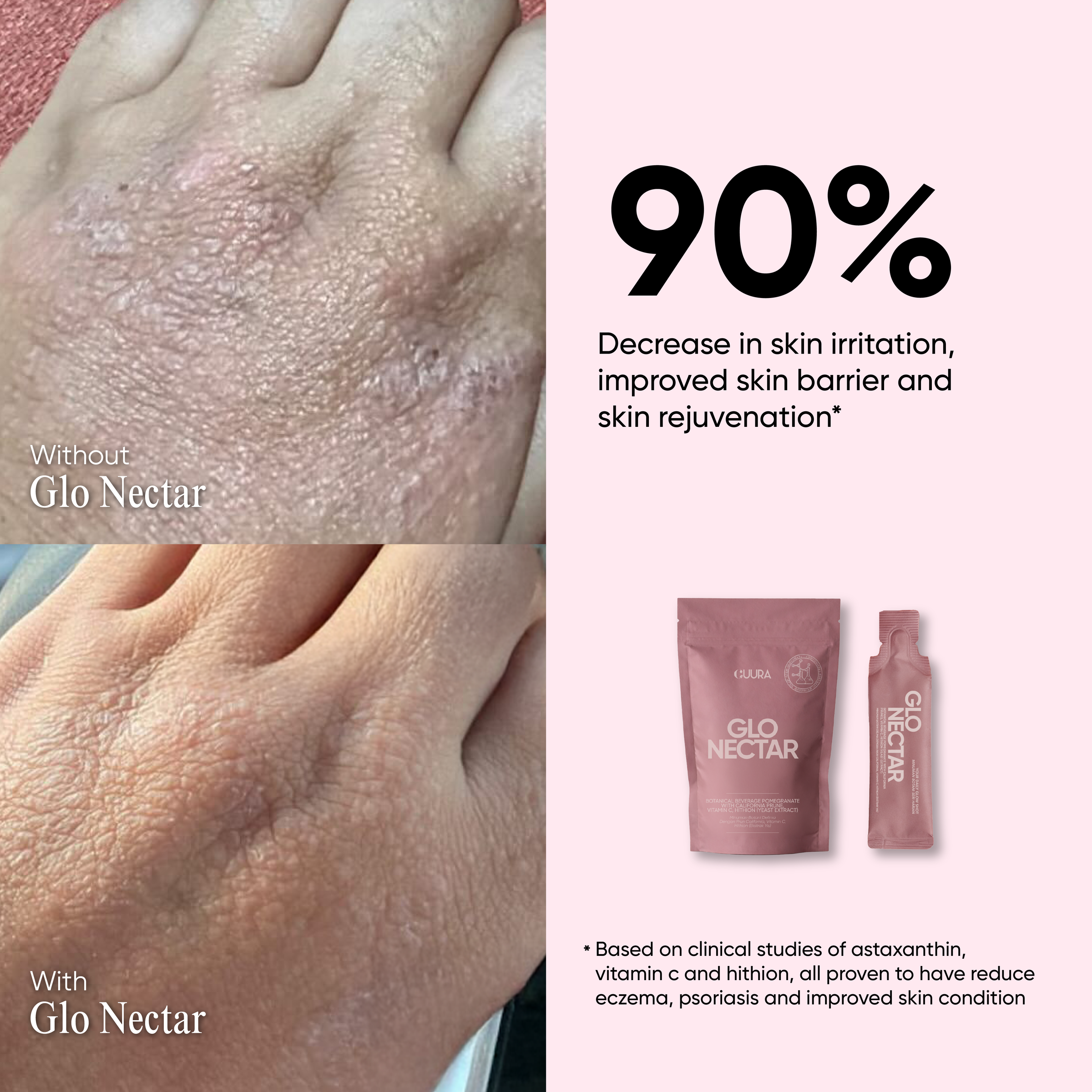 GLONECTAR POSTING-05