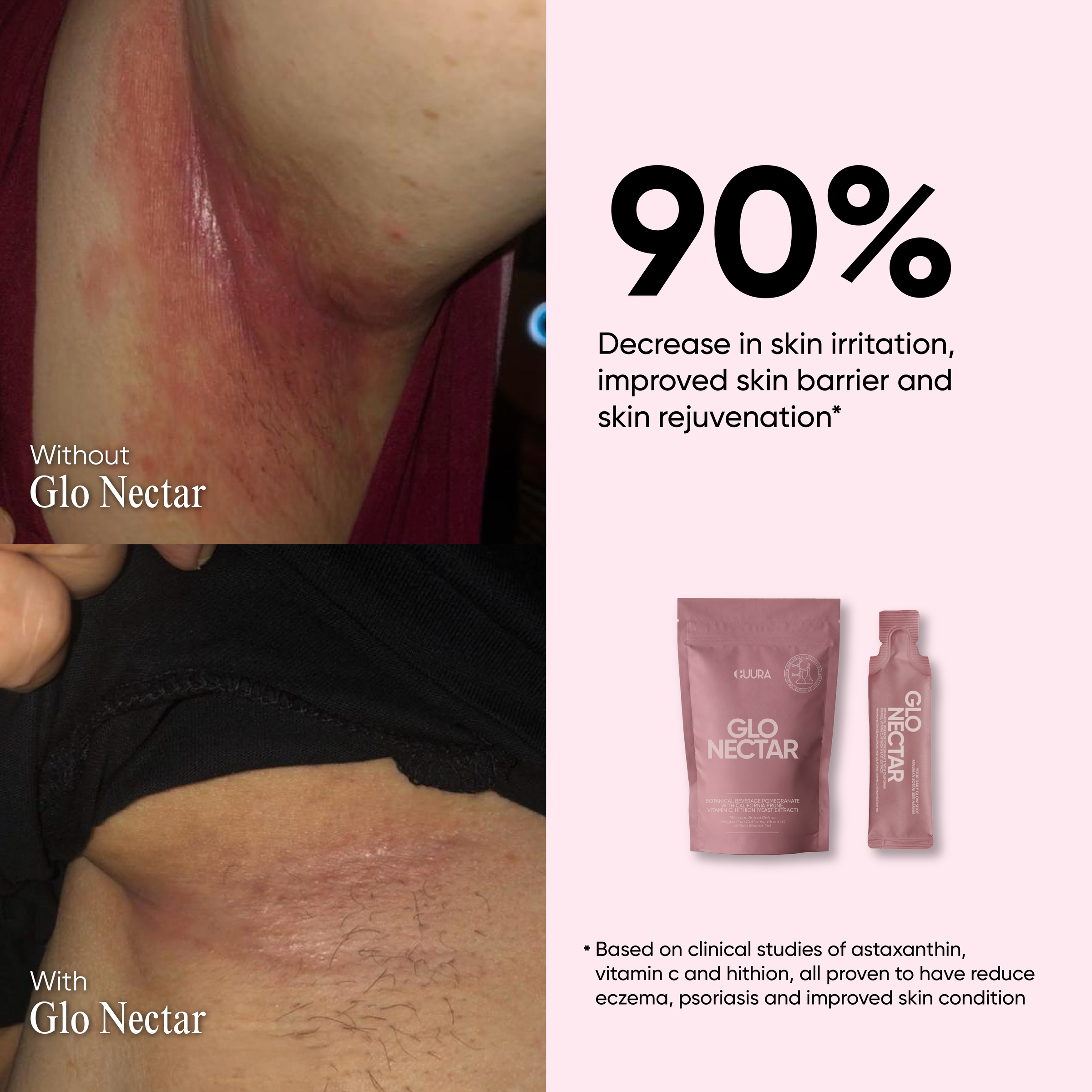 GLONECTAR POSTING-07