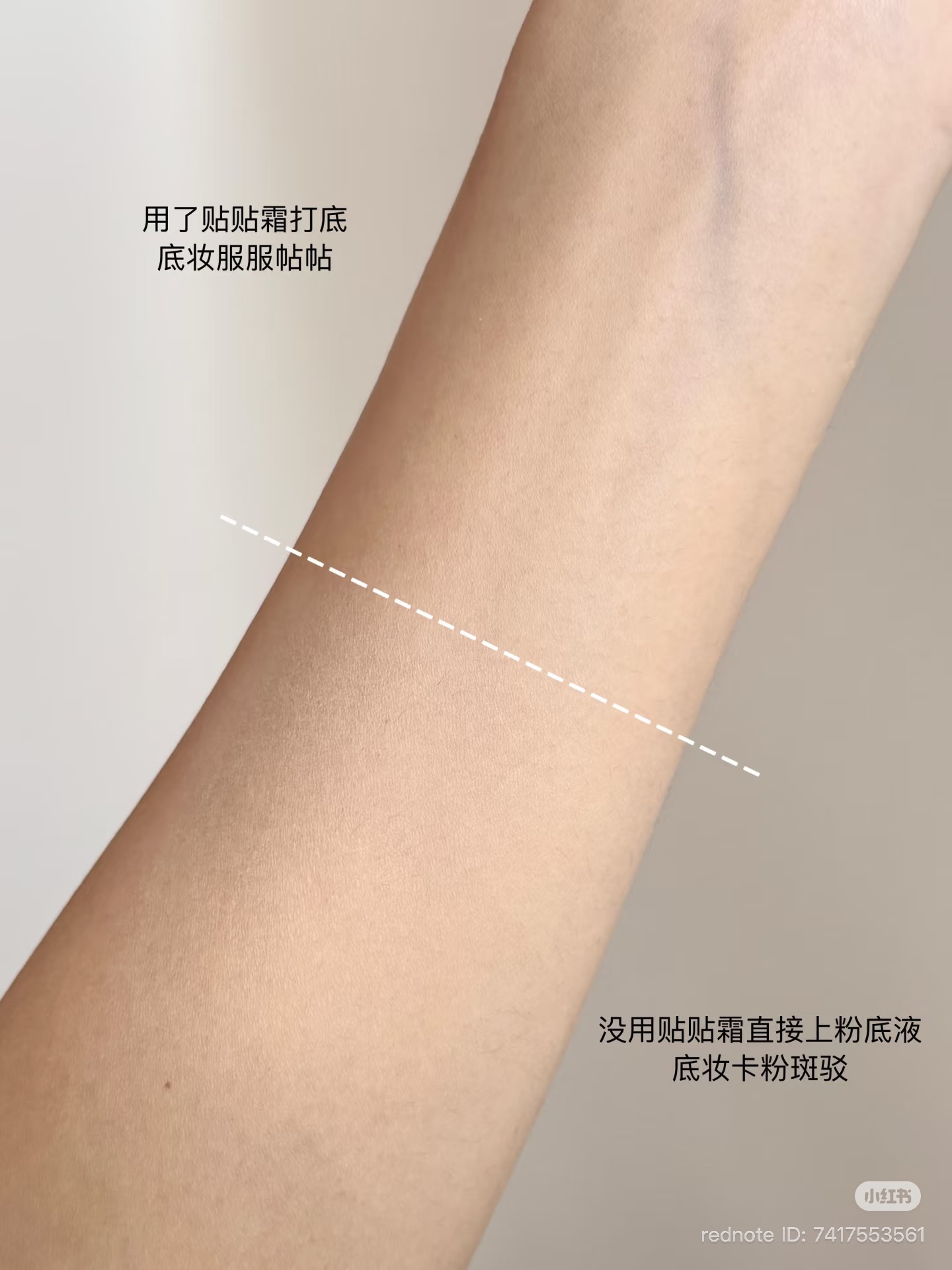 image_AE7BB452-6006-434A-9F52-918D091DD8E2_1774150682