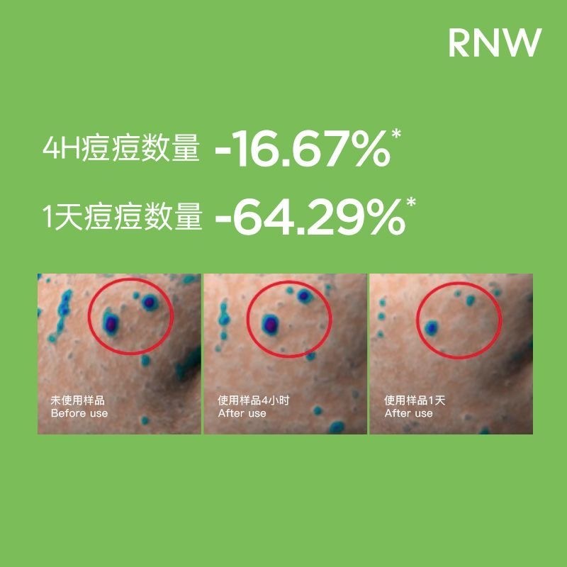 image_2A0DE786-B621-462C-A108-8834E619E33B_1774852693