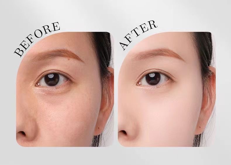 image_561ED698-3237-4D54-9901-1B4EA11E3760_1751023725