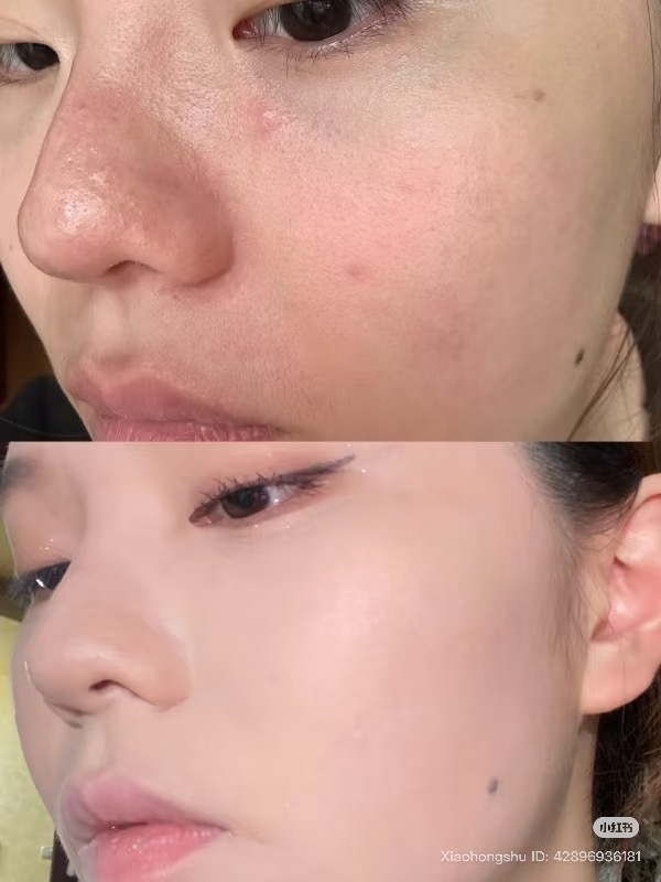 image_7BB633E1-AF1F-4B1A-82B4-874077B7840C_1755164354