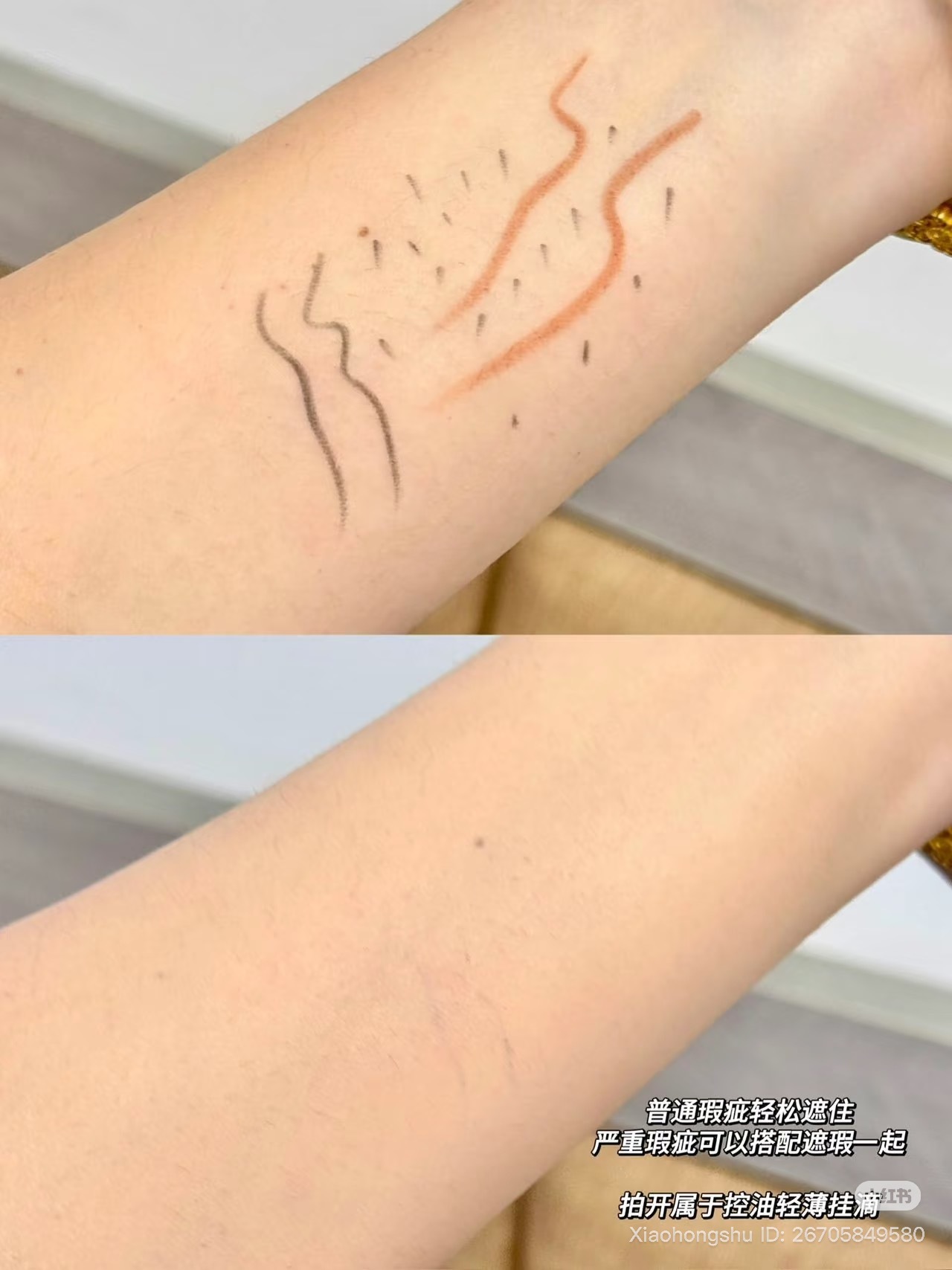 image_0C08A52A-4492-4412-A9DA-DABB76A2BD74_1755164354