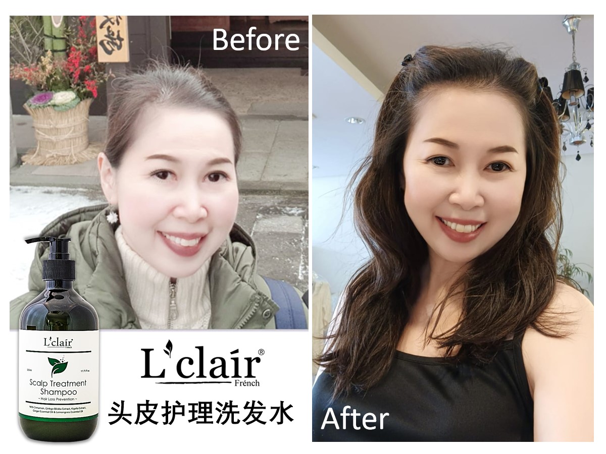 Kellyn shampoo result