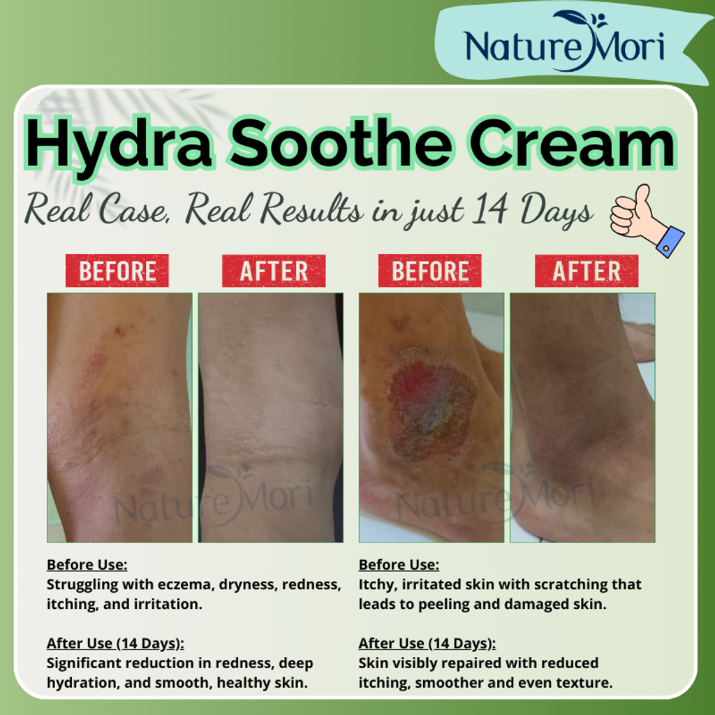 Hydra_Soothe_Cream_3