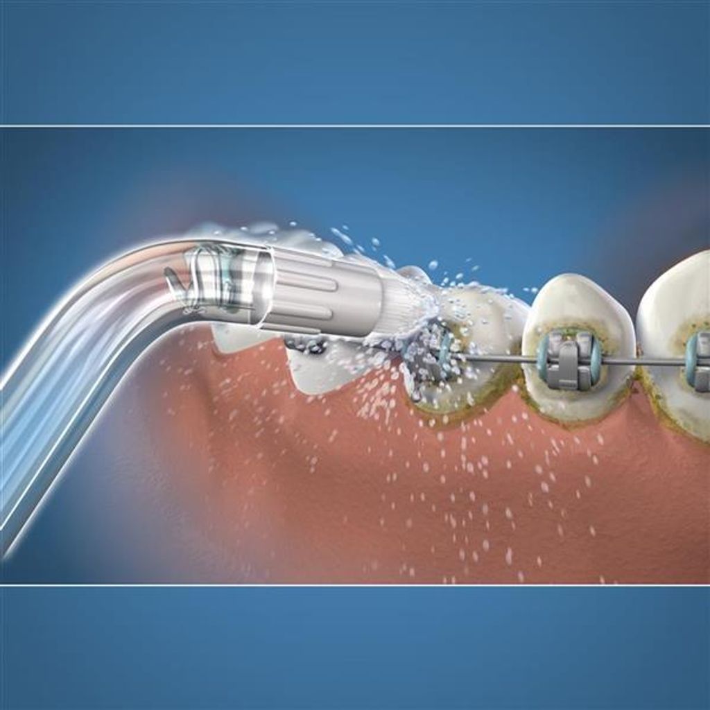 orthodontic-tip-771686