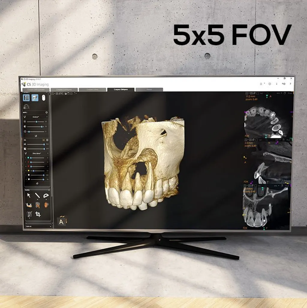 carestream-cs8200-3d-neo-edition-744426