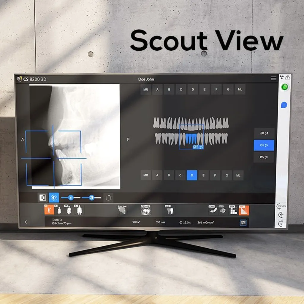 carestream-cs8200-3d-neo-edition-347126