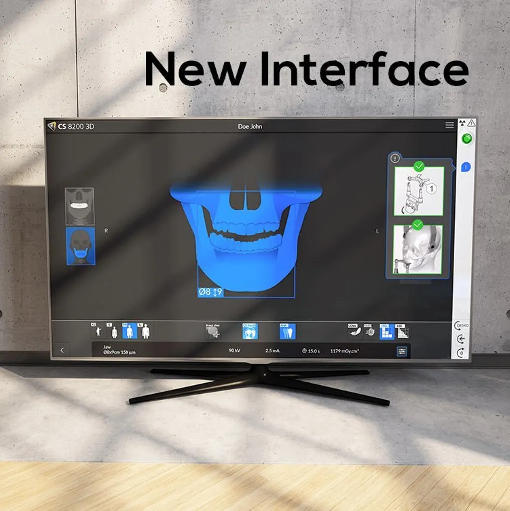 carestream-cs8200-3d-neo-edition-430012
