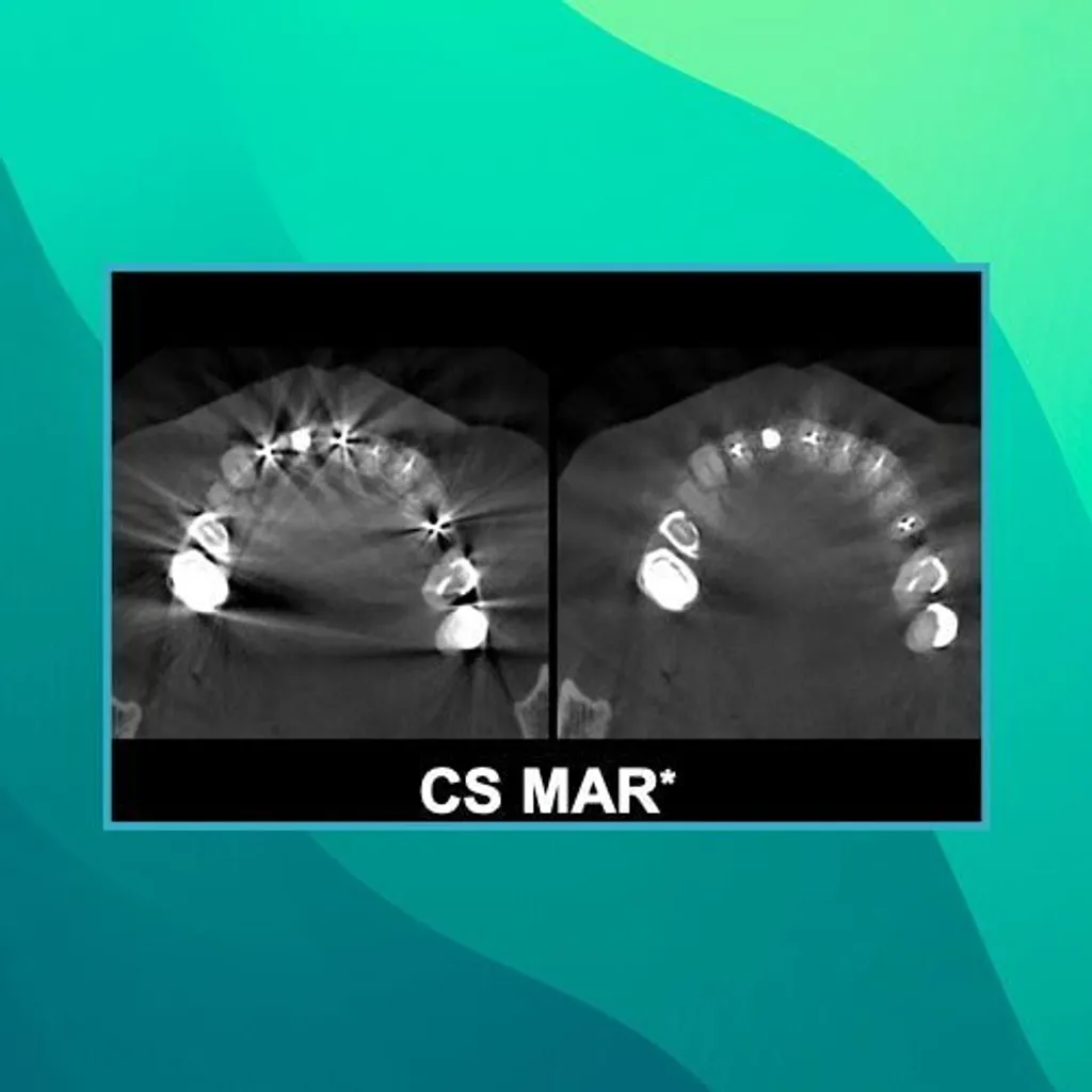carestream-cs9600-3d-cbct-531104
