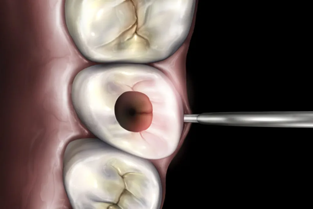 Microlux_2_Attachments_Technical_Detail_1_-_Endo_Lite