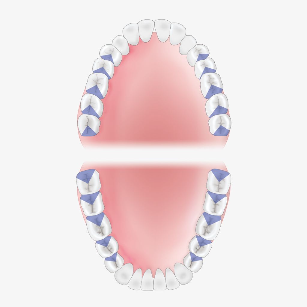 Mouth-Guide_G13-18