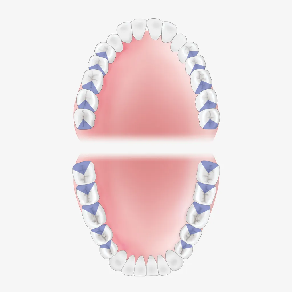 Mouth-Guide_G13-18
