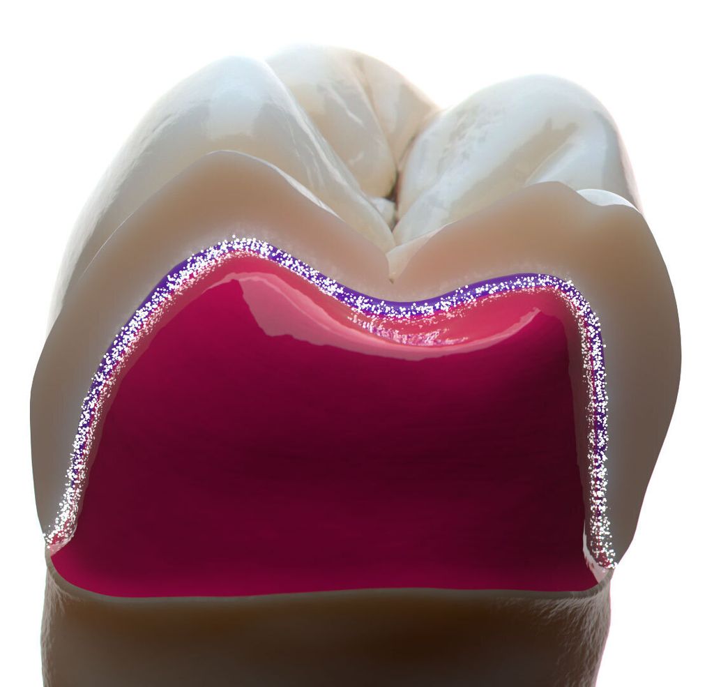 crown_0060