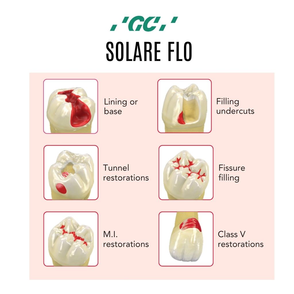 GC Solare Flo (2)