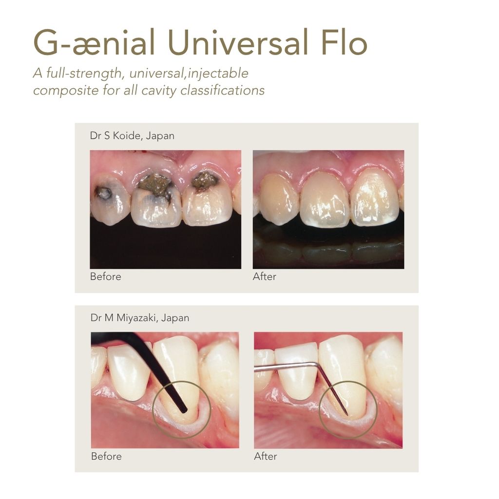 GC G-Aenial Universal Flo 2