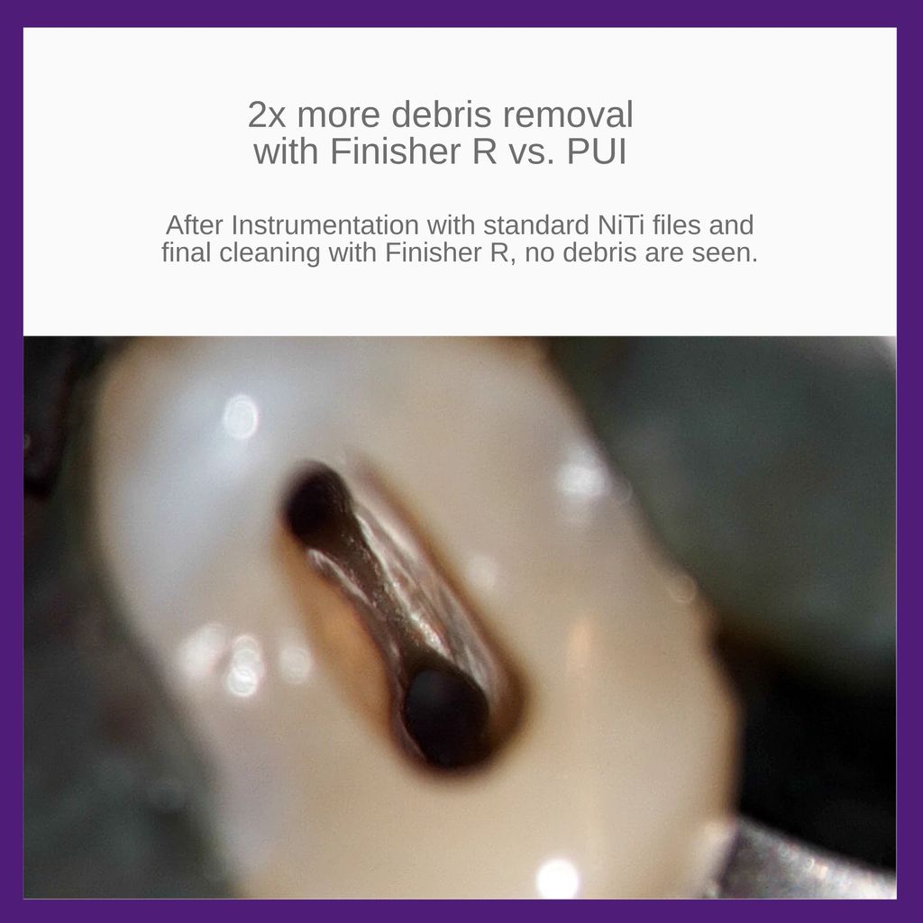 FKG XP-Endo Finisher R 6