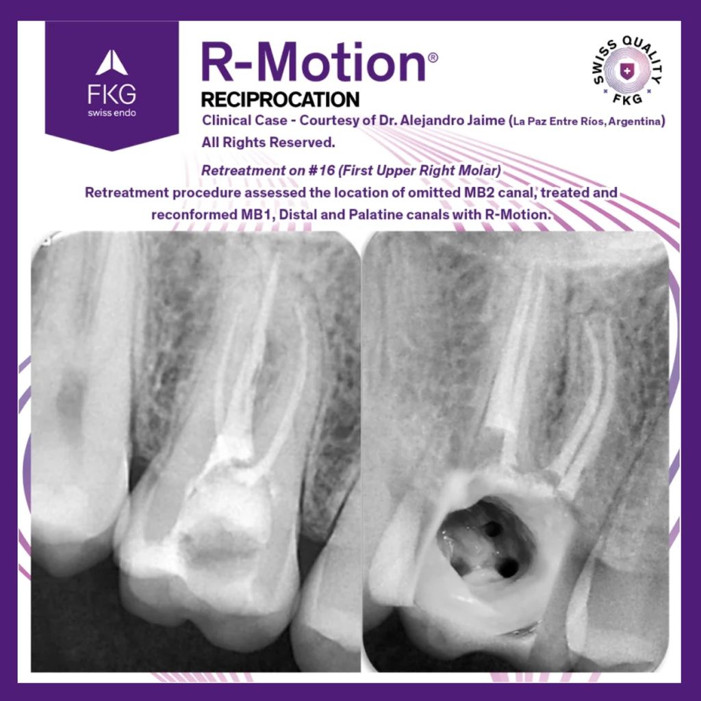 FKG R-Motion Shaper 8