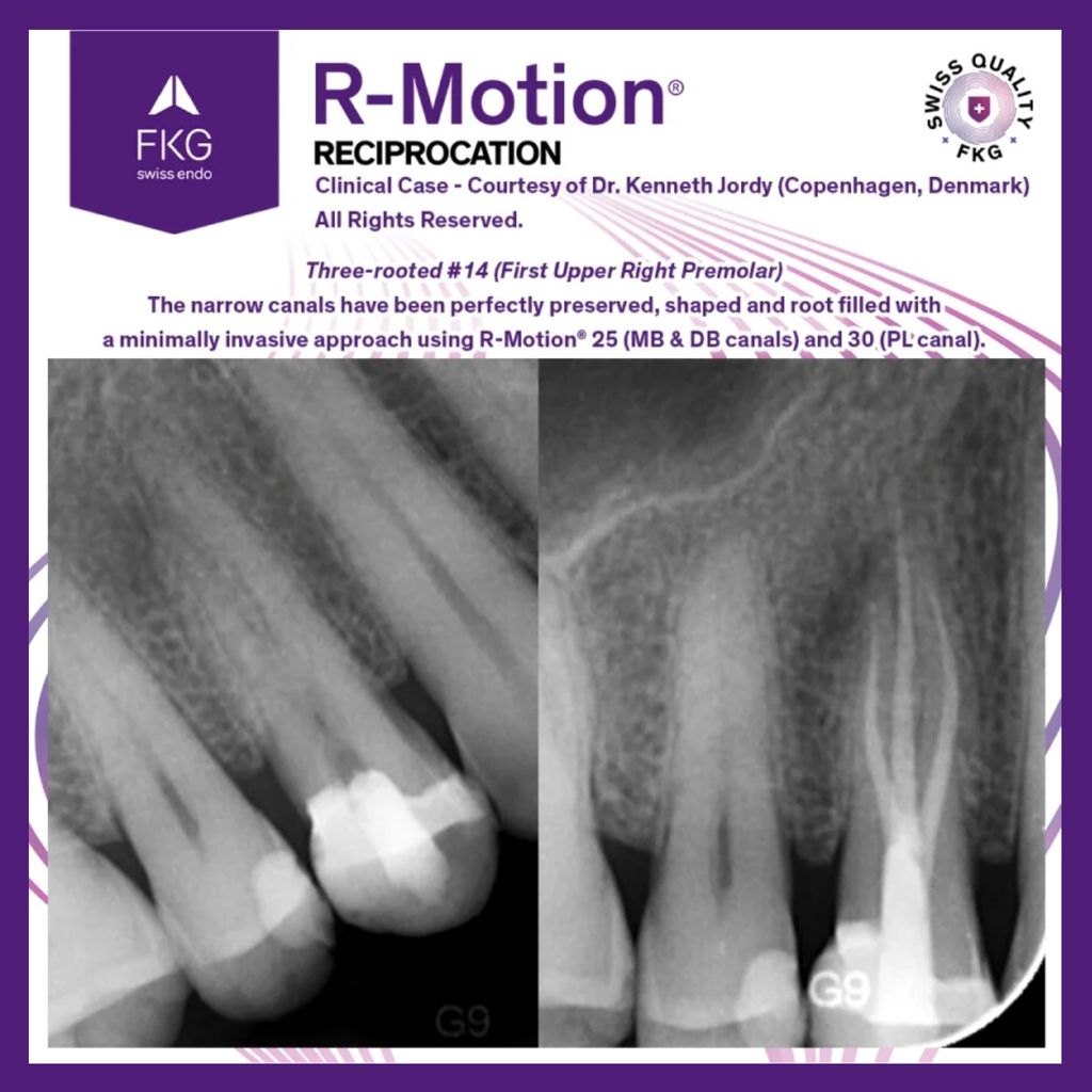 FKG R-Motion Shaper 7