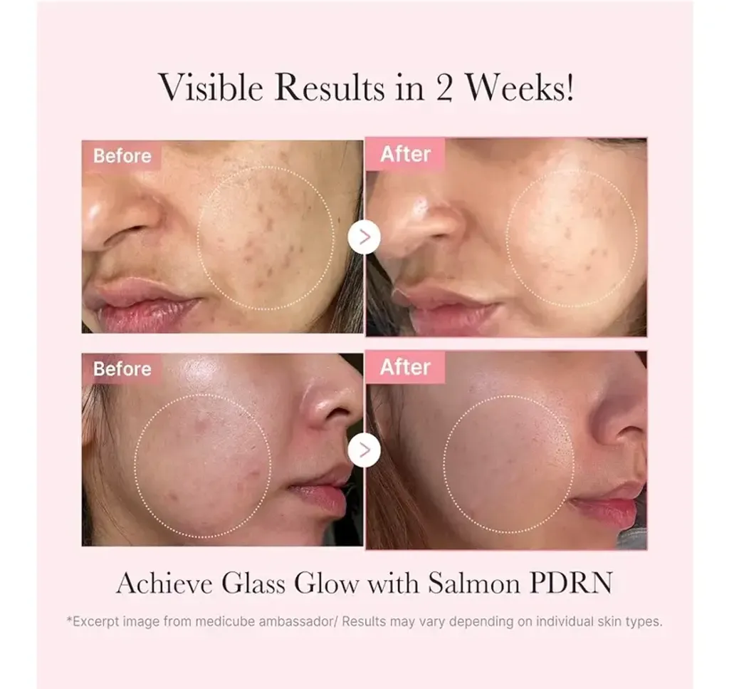 rn-image_picker_lib_temp_222a095f-7c18-4449-a4af-eec3967dd5e5