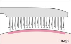 img-02
