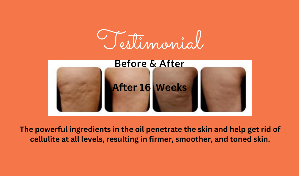 Glam - Anti Cellulite (Before & After) (3)
