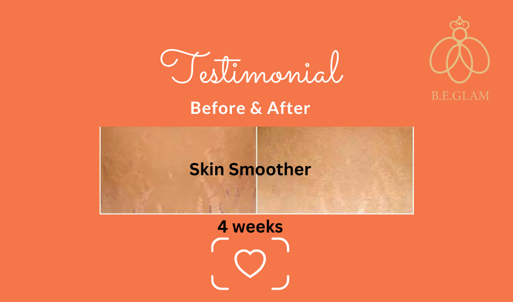 Glam - Anti Cellulite (Before & After)