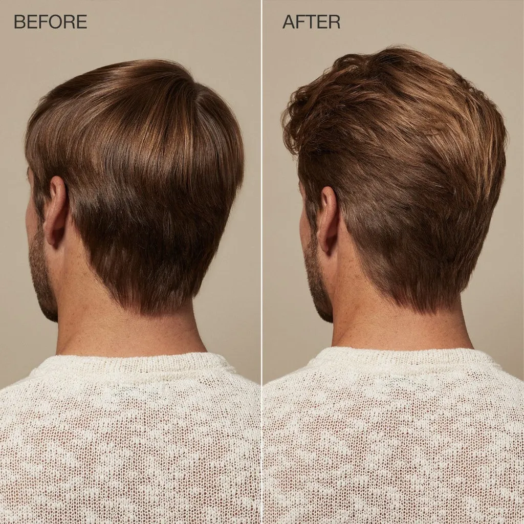 tt_scalpcare_beforeafter_1