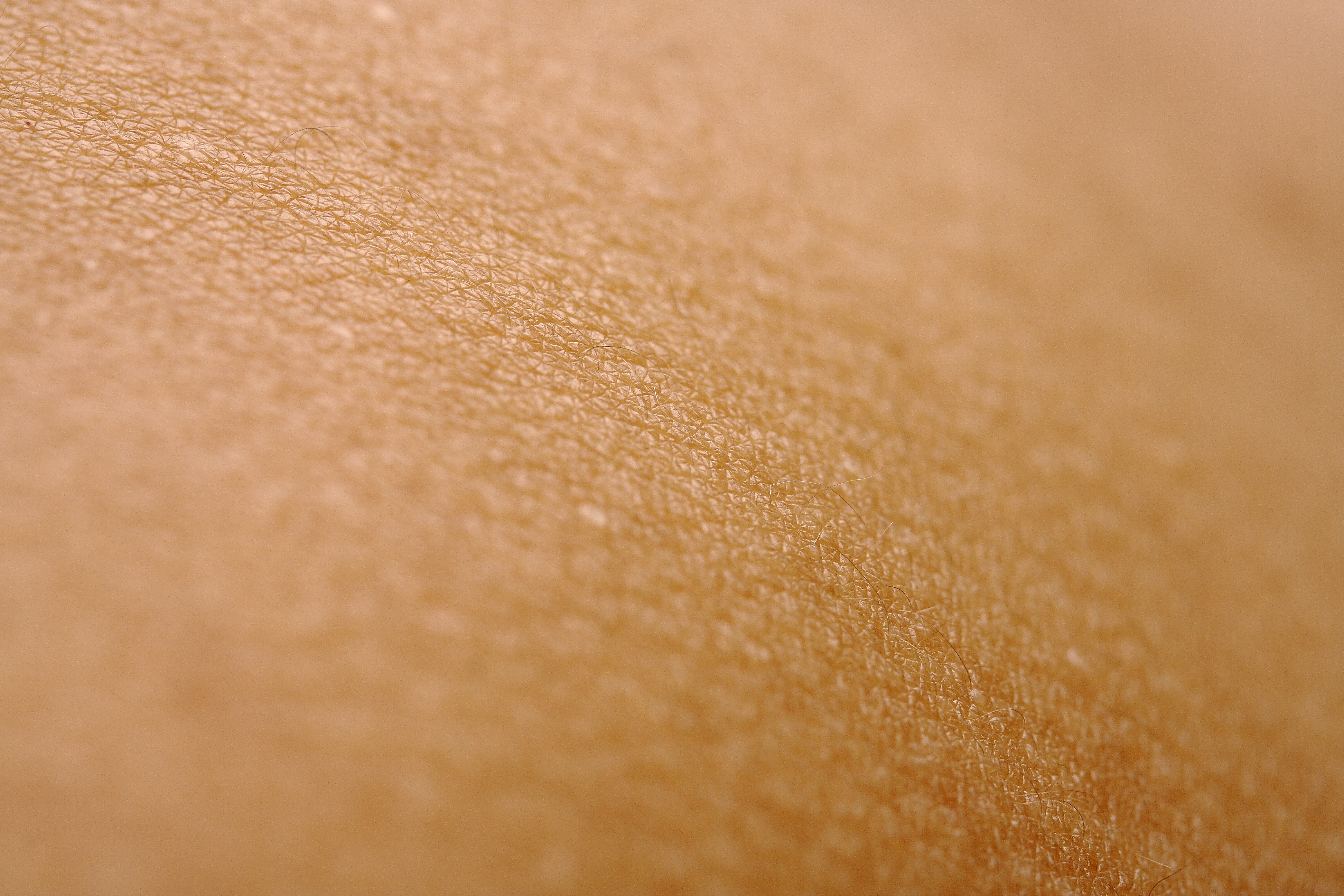 increased-skin
