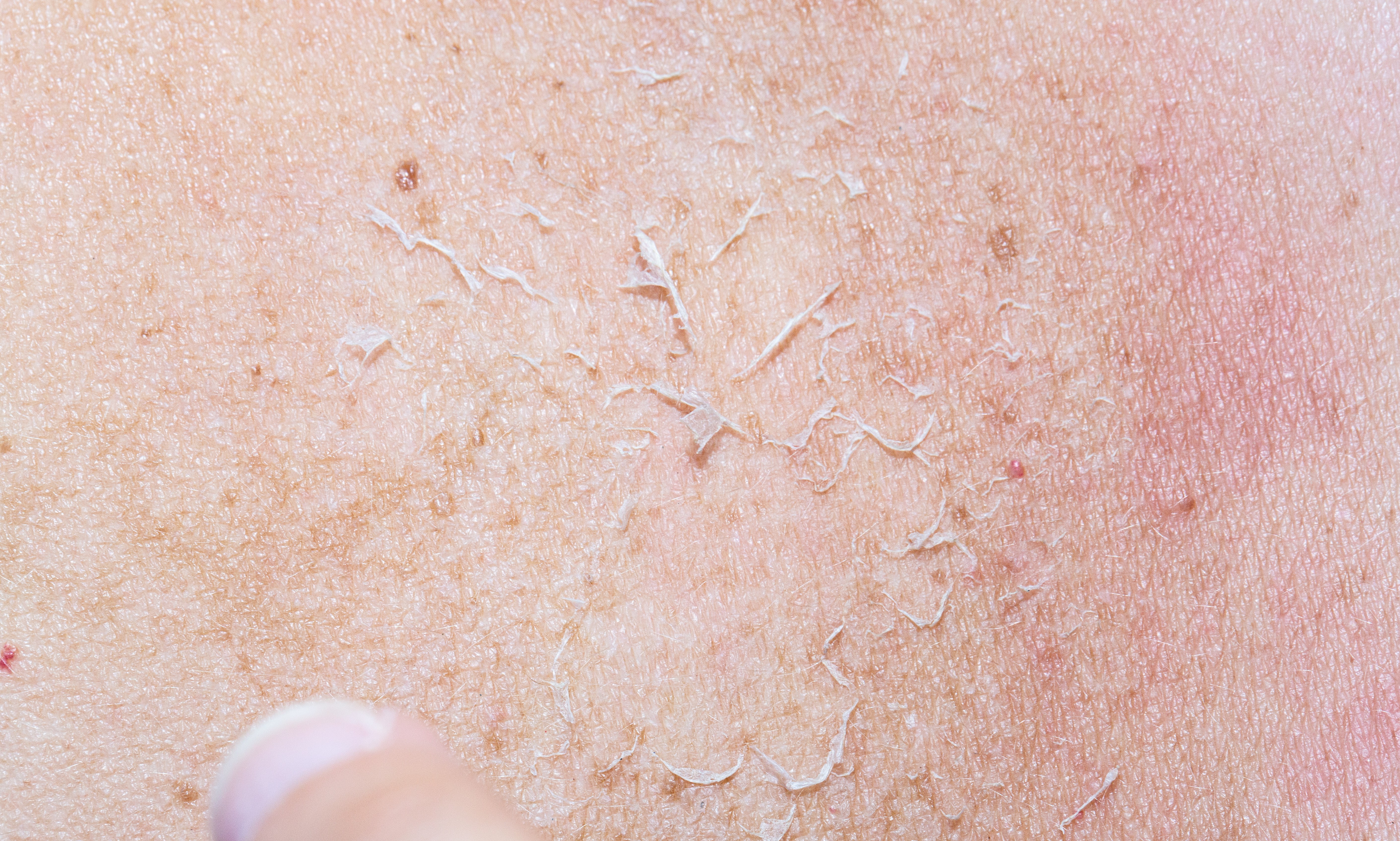 macro-details-dry-skin
