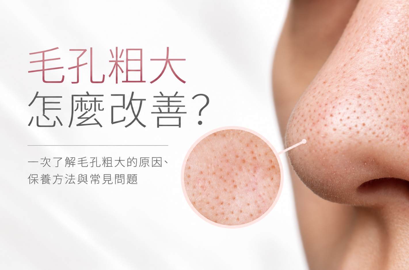 毛孔粗大怎麼改善？一次了解毛孔粗大的原因、保養方法與常見問題
