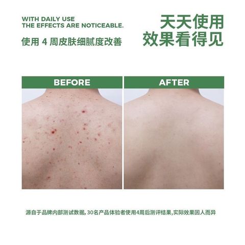 867b1bcbb69994b190b7ed9f2c0371e