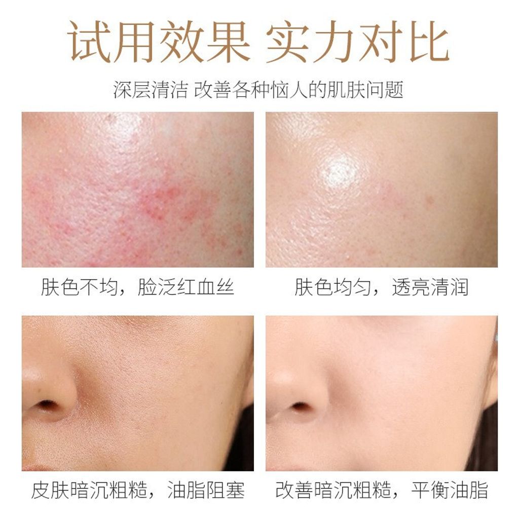 adce1115416ea011b37e78037c4658c2