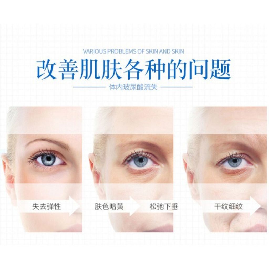 75c47921dd5654680d9ace772a457af6