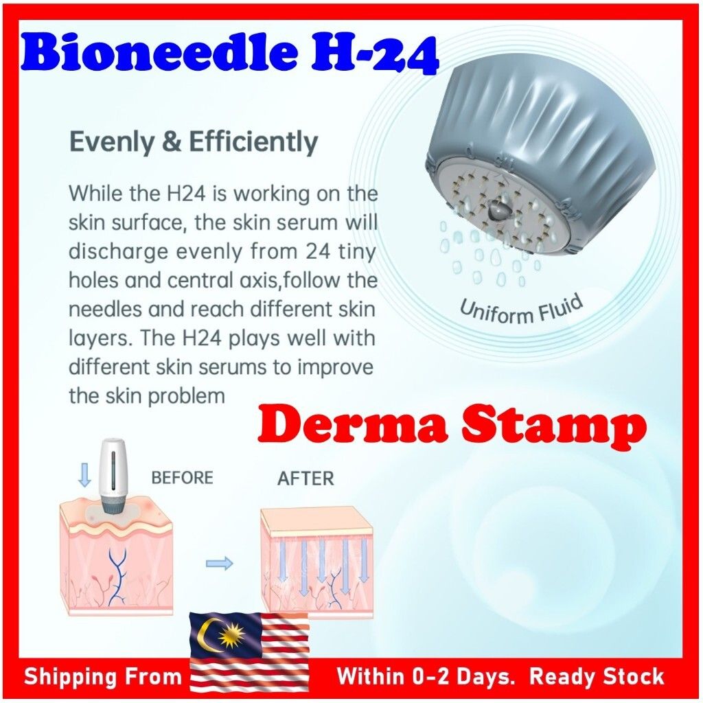 my-11134207-7r98q-lwcuj86orucqb8