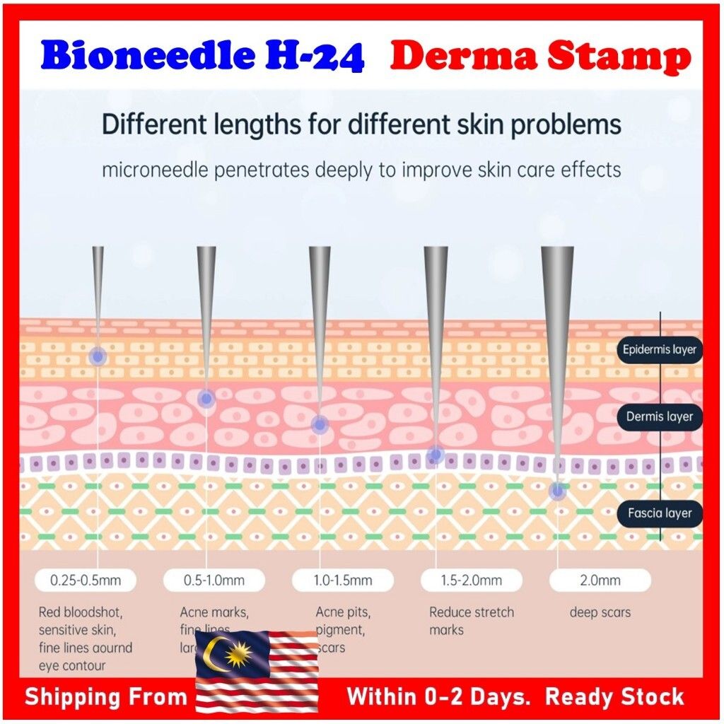 my-11134207-7r98r-lwcuj86op17ue4