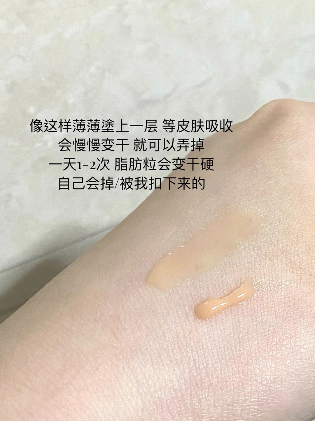 宝藏小众护肤好物 ｜开挂了 去脂肪粒高手！_3_陈甸甸cc_来自小红书网页版