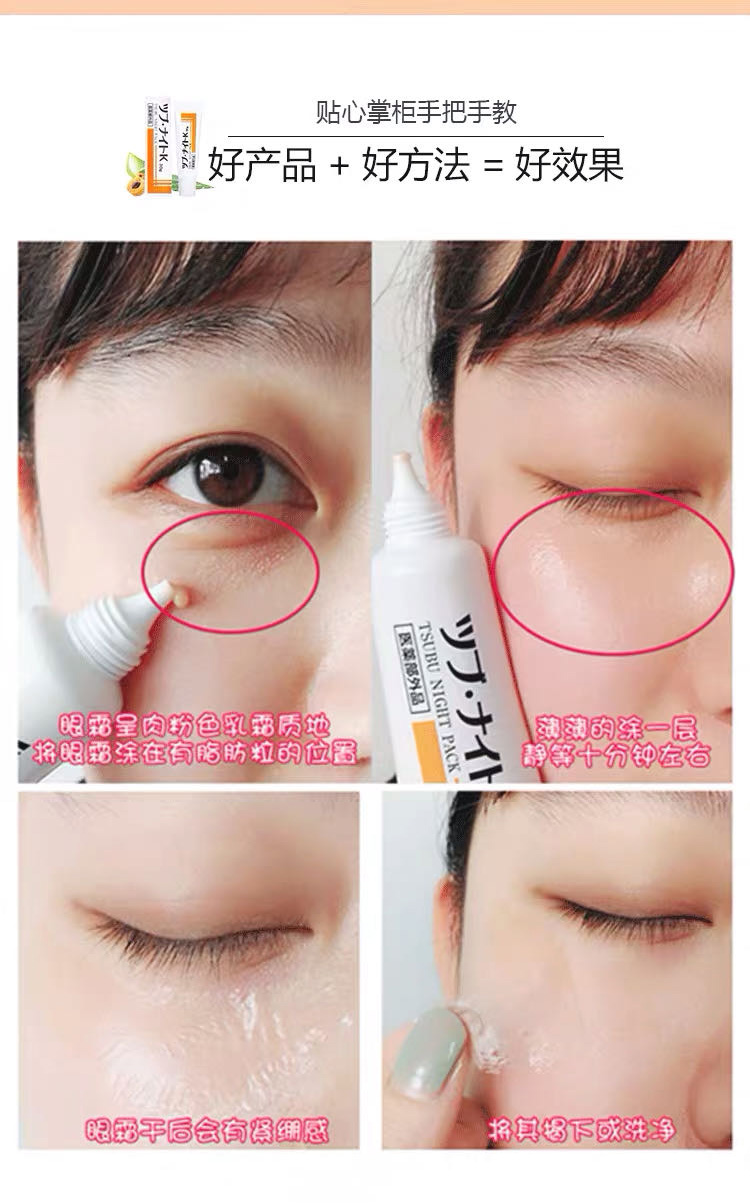 MaskQueen - 日本小林制药-日本TSUBU Night Pack去脂肪粒/角质肉粒乳霜30g